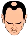 Tipo 4