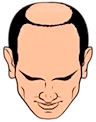 Tipo 6